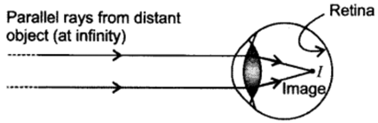 Class 10 Chapter 11 Human Eye and the Colourful World Extra Questions 24 i