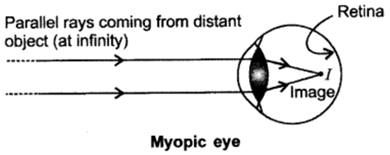 Class 10 Chapter 11 Human Eye and the Colourful World Extra Questions 27 i