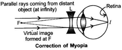 Class 10 Chapter 11 Human Eye and the Colourful World Extra Questions 27 ii