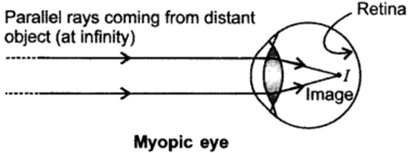 Class 10 Chapter 11 Human Eye and the Colourful World Extra Questions 37