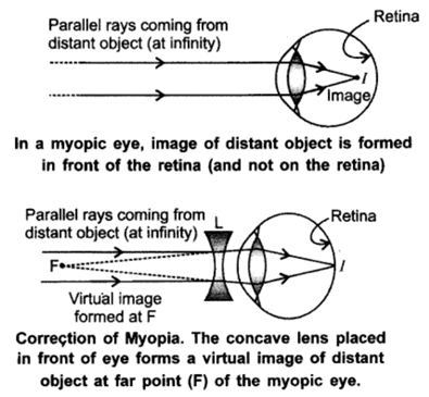 Class 10 Chapter 11 Human Eye and the Colourful World Extra Questions 43