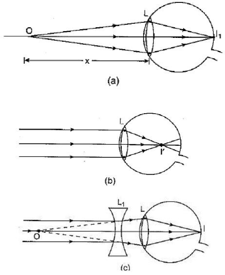 Class 10 Science Chapter 11 Human Eye and the Colourful World Important Question 11 ii