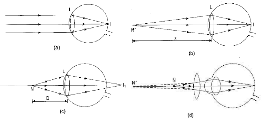 Class 10 Science Chapter 11 Human Eye and the Colourful World Important Question 19