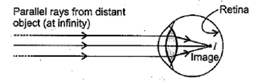 Class 10 Science Chapter 11 Human Eye and the Colourful World Important Question 44 i