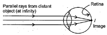 Class 10 Science Chapter 11 Human Eye and the Colourful World Important Question 44 ii