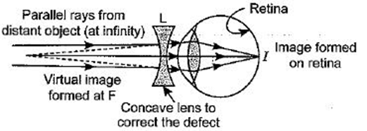 Class 10 Science Chapter 11 Human Eye and the Colourful World Important Question 44 iii